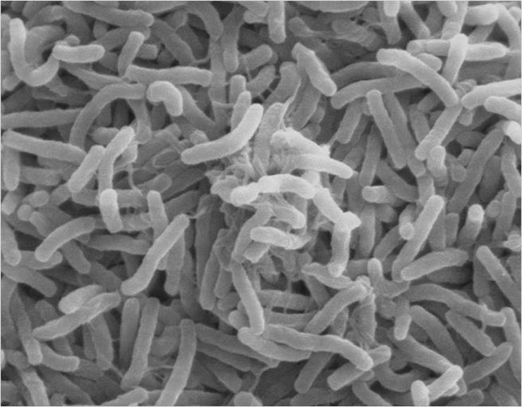 Scanning electron micrograph showing rod-shaped gut bacteria that can degrade uric acid