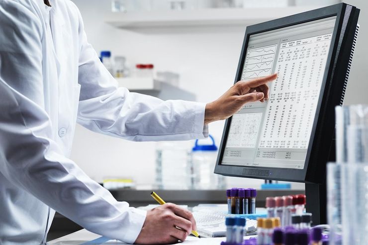 Doctor reviewing blood test results showing uric acid levels on a computer screen