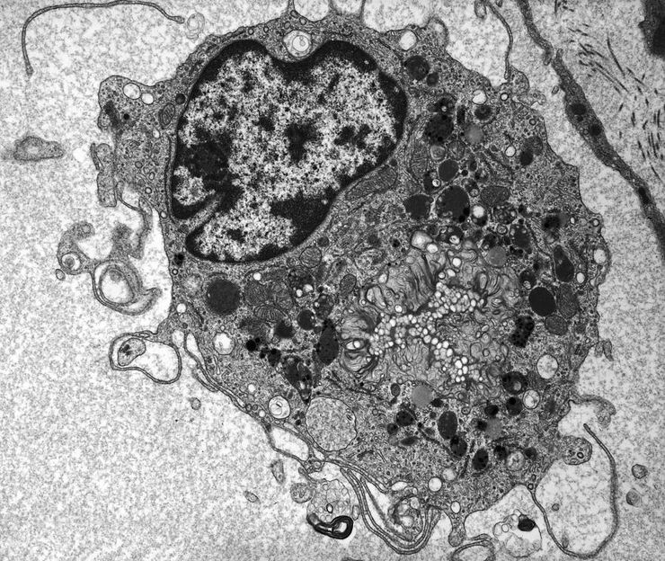 Electron micrograph of a macrophage, the immune cell that activates the NLRP3 inflammasome during a gout attack