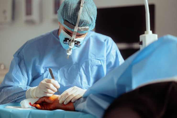 Surgical examination of a hand with visible joint swelling and tophi