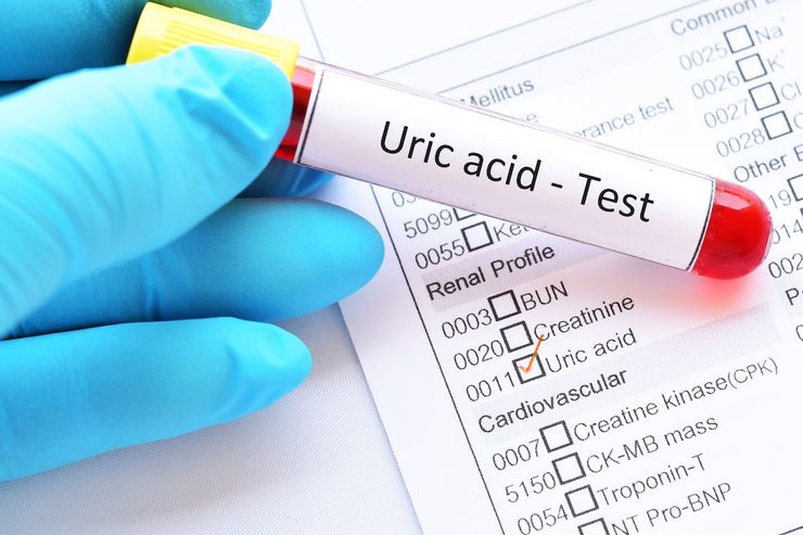 A doctor reviewing kidney function lab results with a patient
