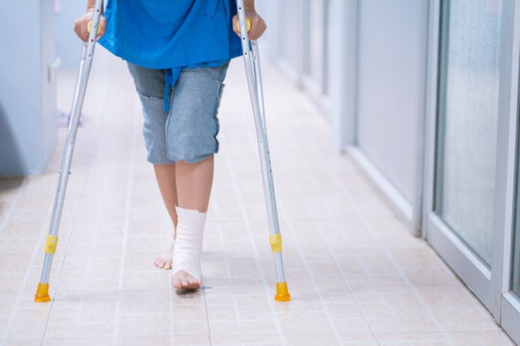 Person using crutches to keep weight off a bandaged foot during a gout flare
