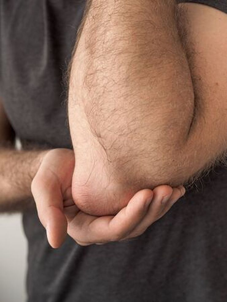 Person holding a painful, swollen elbow with their other hand